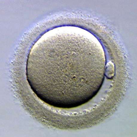 Ovule Ovule